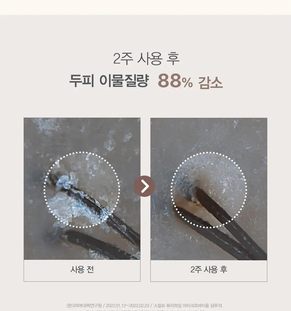 [탈모증상완화/식초샴푸] 원오세븐 스칼프 퓨리파잉 마이크로바이옴 샴푸 380ml 상세페이지 7